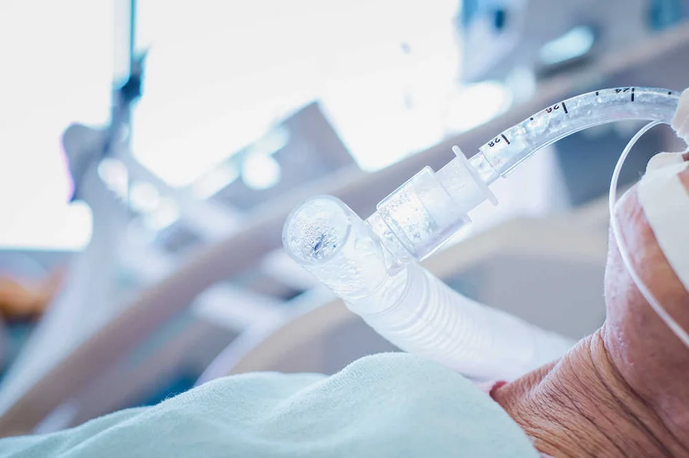 قیمت دستگاه ونتیلاتور